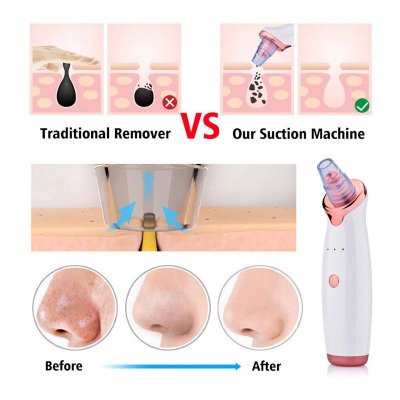 Före och efter bilder med en pormasksug