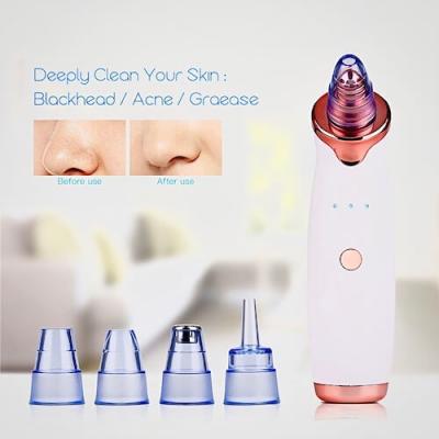 Resultat efter en behandling med pormasksugen